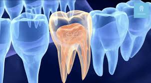 Composite Filling vs Porcelain Inlay: What's the Difference?
